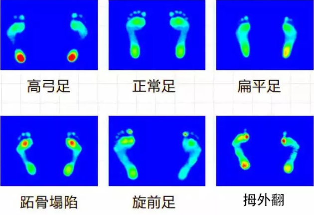 圖片關(guān)鍵詞